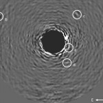 Imagens do sistema planetário que orbita a estrela HR 8799. A letra "a" (que não aparece na imagem) é associada à estrela, e as outras letras "b", "c", "d" e "e" indicam os planetas que a orbitam.